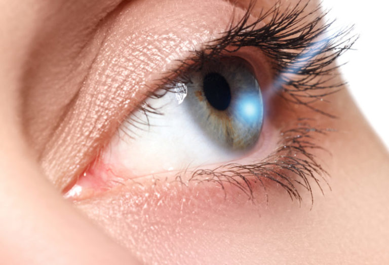 History of Laser Eye Surgery