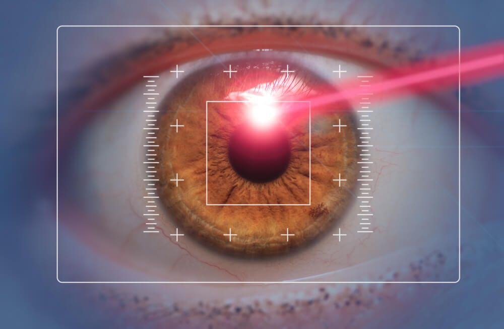 CustomVue LASIK Is More Specific Vision Correction