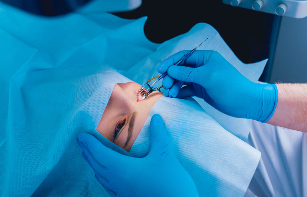 A Patient and Team of Surgeons in the Operating Room During Ophthalmic Surgery.