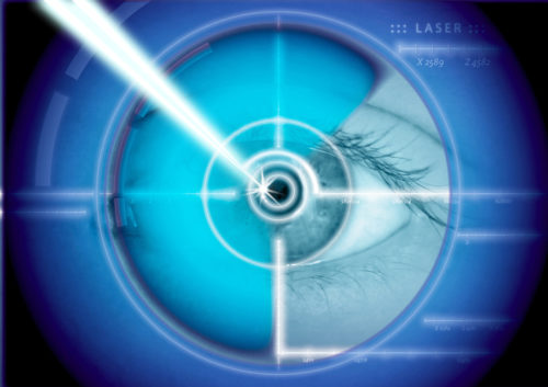 Image of eye laser correction