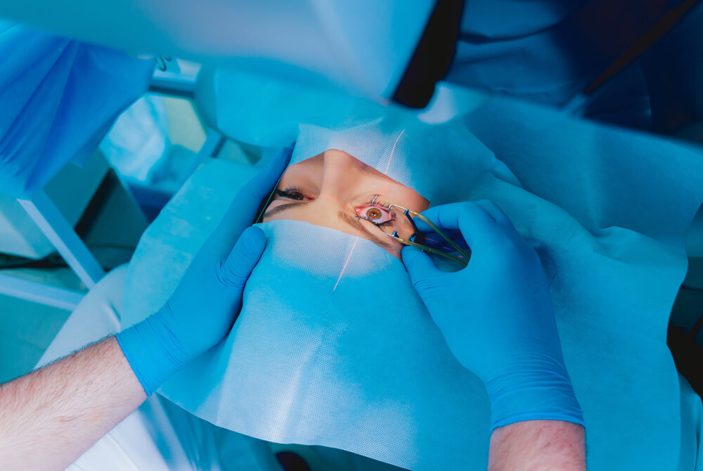 Laser Vision Correction. A Patient and Team of Surgeons in the Operating Room During Ophthalmic Surgery