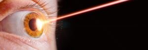 Laser Eye Surgery Or Lasik Concept Close Up Of Female Eye With Beam Of Light Hitting The Irs