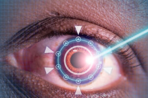 Laser or Lasik Eye Surgery concept.